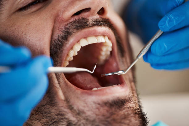 Best Sedation Dentistry  in Booker, TX